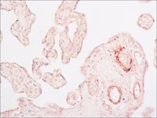Monoclonal Anti-Caldesmon (Smooth) antibody produced in mouse clone hHCD, ascites fluid
