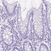 Anti-DNAH2 antibody produced in rabbit Prestige Antibodies&#174; Powered by Atlas Antibodies, affinity isolated antibody, buffered aqueous glycerol solution