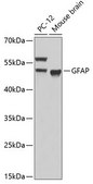 Anti-GFAP antibody produced in rabbit