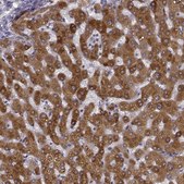 Anti-GHR antibody produced in rabbit Prestige Antibodies&#174; Powered by Atlas Antibodies, affinity isolated antibody