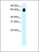 Anti-TRIM32 (AB2) antibody produced in rabbit IgG fraction of antiserum