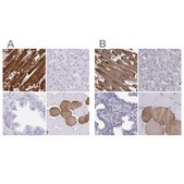 Anti-TNNC1 antibody produced in rabbit Prestige Antibodies&#174; Powered by Atlas Antibodies, affinity isolated antibody, buffered aqueous glycerol solution
