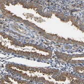 Anti-IQGAP1 antibody produced in rabbit Prestige Antibodies&#174; Powered by Atlas Antibodies, affinity isolated antibody, buffered aqueous glycerol solution