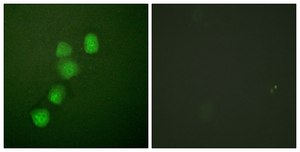 Anti-Cyclin E1 antibody produced in rabbit affinity isolated antibody
