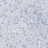 Anti-MYBPC1 antibody produced in rabbit Prestige Antibodies&#174; Powered by Atlas Antibodies, affinity isolated antibody, buffered aqueous glycerol solution