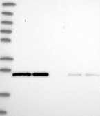 Anti-RALA antibody produced in rabbit Prestige Antibodies&#174; Powered by Atlas Antibodies, affinity isolated antibody, buffered aqueous glycerol solution