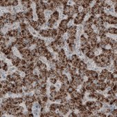 Monoclonal Anti-ACAA1 antibody produced in mouse Prestige Antibodies&#174; Powered by Atlas Antibodies, clone CL2650, purified immunoglobulin, buffered aqueous glycerol solution