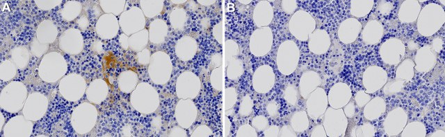 Anti-CD62E Antibody, clone 1I3-H1 ZooMAb&#174; Rabbit Monoclonal recombinant, expressed in HEK 293 cells