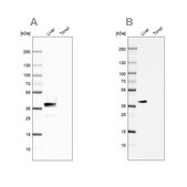 Anti-ARG1 antibody produced in rabbit Prestige Antibodies&#174; Powered by Atlas Antibodies, affinity isolated antibody, buffered aqueous glycerol solution