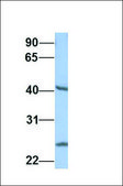 Anti-IDH1 (ab1) antibody produced in rabbit affinity isolated antibody