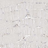 Anti-SYVN1 antibody produced in rabbit Prestige Antibodies&#174; Powered by Atlas Antibodies, affinity isolated antibody, buffered aqueous glycerol solution