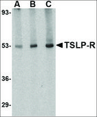 Anti-TSLP Receptor (ab1) antibody produced in rabbit affinity isolated antibody, buffered aqueous solution