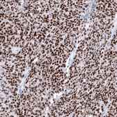 Anti-WT1 antibody produced in mouse Prestige Antibodies&#174; Powered by Atlas Antibodies, clone CL13176, purified by using Protein A, buffered aqueous glycerol solution