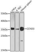 Anti-CCND3 antibody produced in rabbit