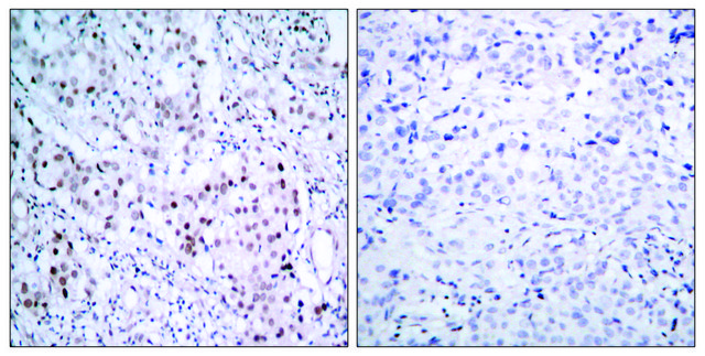 Anti-phospho-c-Jun (pSer63) antibody produced in rabbit affinity isolated antibody