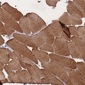 Anti-LDB3 antibody produced in rabbit Prestige Antibodies&#174; Powered by Atlas Antibodies, affinity isolated antibody, buffered aqueous glycerol solution