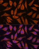 Anti-SMYD3 antibody produced in rabbit
