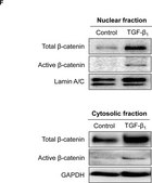 Anti-Active-&#946;-Catenin (Anti-ABC) Antibody, clone 8E7 clone 8E7, Upstate&#174;, from mouse