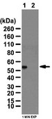 Anti-phospho-ILK (Ser246) Antibody from rabbit, purified by affinity chromatography