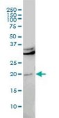 Monoclonal Anti-CBX5 antibody produced in mouse clone 1E11-3A10, purified immunoglobulin, buffered aqueous solution