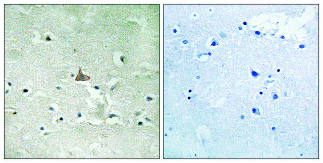 Anti-phospho-Trk B (pTyr706/Tyr707) antibody produced in rabbit affinity isolated antibody