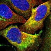 Anti-SPINT1 antibody produced in rabbit Prestige Antibodies&#174; Powered by Atlas Antibodies, affinity isolated antibody, buffered aqueous glycerol solution