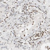 Anti-PRKAG2 antibody produced in rabbit Prestige Antibodies&#174; Powered by Atlas Antibodies, affinity isolated antibody, buffered aqueous glycerol solution