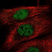 Anti-TBK1 antibody produced in rabbit Prestige Antibodies&#174; Powered by Atlas Antibodies, affinity isolated antibody, buffered aqueous glycerol solution