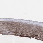 Anti-TGFBI antibody produced in rabbit Prestige Antibodies&#174; Powered by Atlas Antibodies, affinity isolated antibody, buffered aqueous glycerol solution