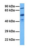 Anti-FN1 antibody produced in rabbit affinity isolated antibody