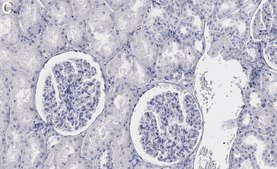 Anti-β-Arrestin 1 Antibody, clone 1B15 ZooMAb&#174; Rabbit Monoclonal recombinant, expressed in HEK 293 cells
