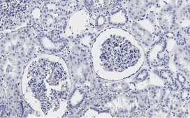 Anti-PLD2 Antibody, clone 6F13 ZooMAb® Rabbit Monoclonal recombinant, expressed in HEK 293 cells
