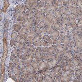 Anti-STS antibody produced in rabbit Prestige Antibodies&#174; Powered by Atlas Antibodies, affinity isolated antibody, buffered aqueous glycerol solution