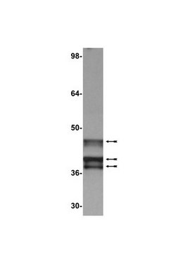 Anti-E1A (Ad2/Ad5) Antibody, clone M73 clone M73, Upstate&#174;, from mouse