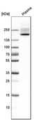Anti-CFH antibody produced in rabbit Prestige Antibodies&#174; Powered by Atlas Antibodies, affinity isolated antibody, buffered aqueous glycerol solution