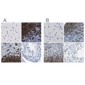 Anti-MS4A1 antibody produced in rabbit Prestige Antibodies&#174; Powered by Atlas Antibodies, affinity isolated antibody, buffered aqueous glycerol solution