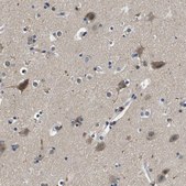 Anti-KCNQ5 antibody produced in rabbit Prestige Antibodies&#174; Powered by Atlas Antibodies, affinity isolated antibody, buffered aqueous glycerol solution