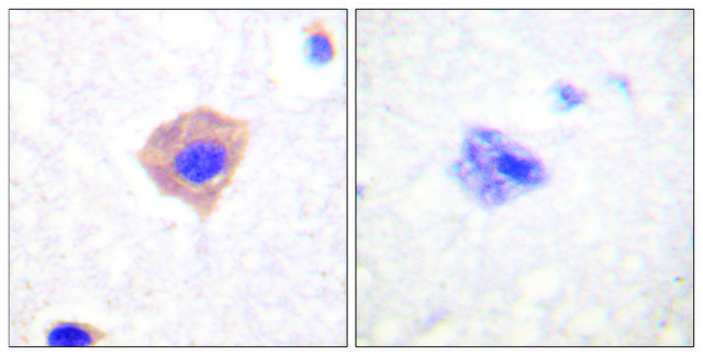 Anti-Catalase antibody produced in rabbit affinity isolated antibody