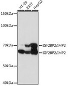 Anti-IGF2BP2/IMP2 antibody produced in rabbit