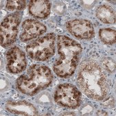 Monoclonal Anti-ACAA1 antibody produced in mouse Prestige Antibodies&#174; Powered by Atlas Antibodies, clone CL2663, purified immunoglobulin, buffered aqueous glycerol solution