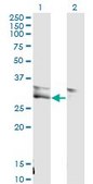 Monoclonal Anti-VWF antibody produced in mouse clone 1A11, purified immunoglobulin, buffered aqueous solution