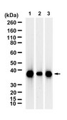 Anti-Claudin-18 Antibody, clone 1G17 ZooMAb&#174; Rabbit Monoclonal recombinant, expressed in HEK 293 cells