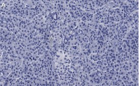Anti-ZNF598 Antibody, clone 3N7, ZooMAb&#174; Rabbit Monoclonal recombinant, expressed in HEK 293 cells