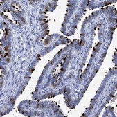 Anti-RSPH1 antibody produced in rabbit Prestige Antibodies&#174; Powered by Atlas Antibodies, affinity isolated antibody, buffered aqueous glycerol solution