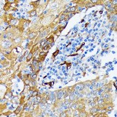 Anti-Fascin/FSCN1 antibody produced in rabbit