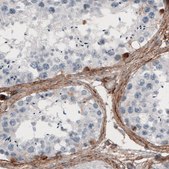 Monoclonal Anti-FN1 antibody produced in mouse Prestige Antibodies&#174; Powered by Atlas Antibodies, clone CL3730, purified immunoglobulin, buffered aqueous glycerol solution