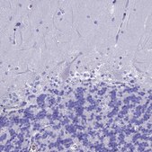 Anti-ADH7 antibody produced in rabbit Prestige Antibodies&#174; Powered by Atlas Antibodies, affinity isolated antibody, buffered aqueous glycerol solution