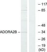 Anti-ADORA2B antibody produced in rabbit affinity isolated antibody