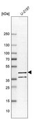 Anti-PDE7B antibody produced in rabbit Prestige Antibodies® Powered by Atlas Antibodies, affinity isolated antibody, buffered aqueous glycerol solution