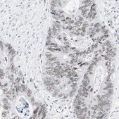Anti-ARID1A antibody produced in rabbit Prestige Antibodies&#174; Powered by Atlas Antibodies, affinity isolated antibody, buffered aqueous glycerol solution